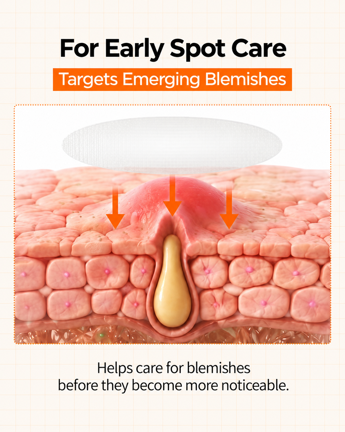 Senairy ZERO-FIT Ultra Thin Blemish & Dark Spot Patch Duo