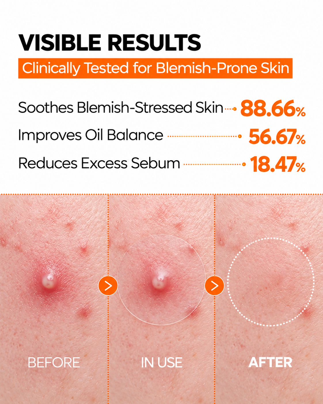 Senairy ZERO-FIT Ultra Thin Blemish & Dark Spot Patch Duo
