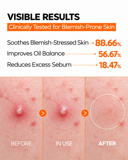 Senairy ZERO-FIT Ultra Thin Blemish & Dark Spot Patch Duo